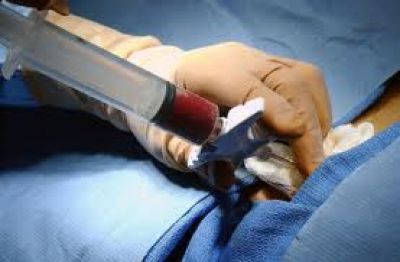  Convocan a los marplatenses para que formen parte del Registro Nacional de Donantes de M�dula �sea