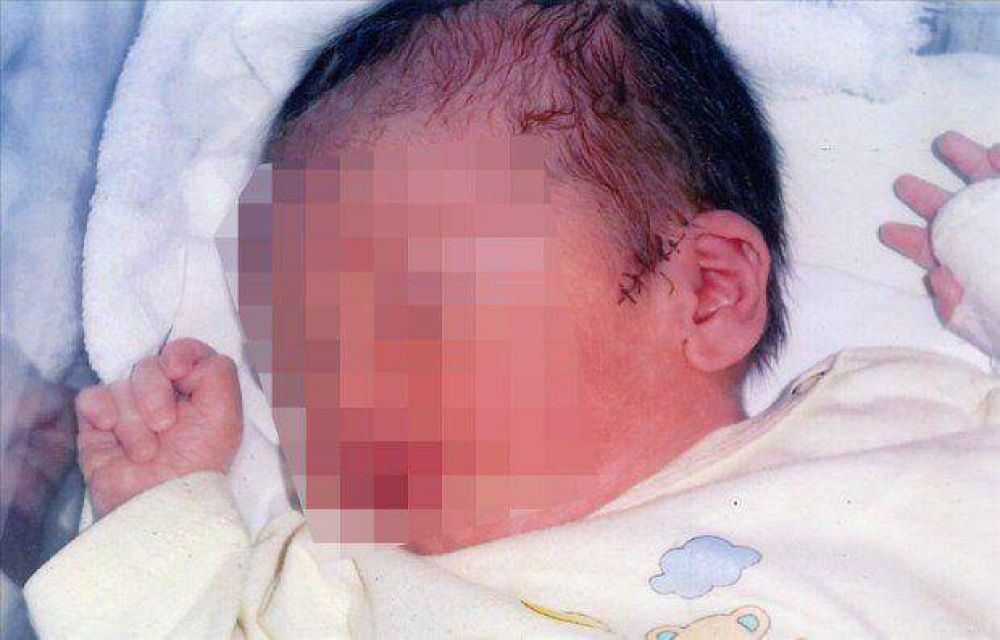 M�dicos lastimaron a un reci�n nacido en Tartagal