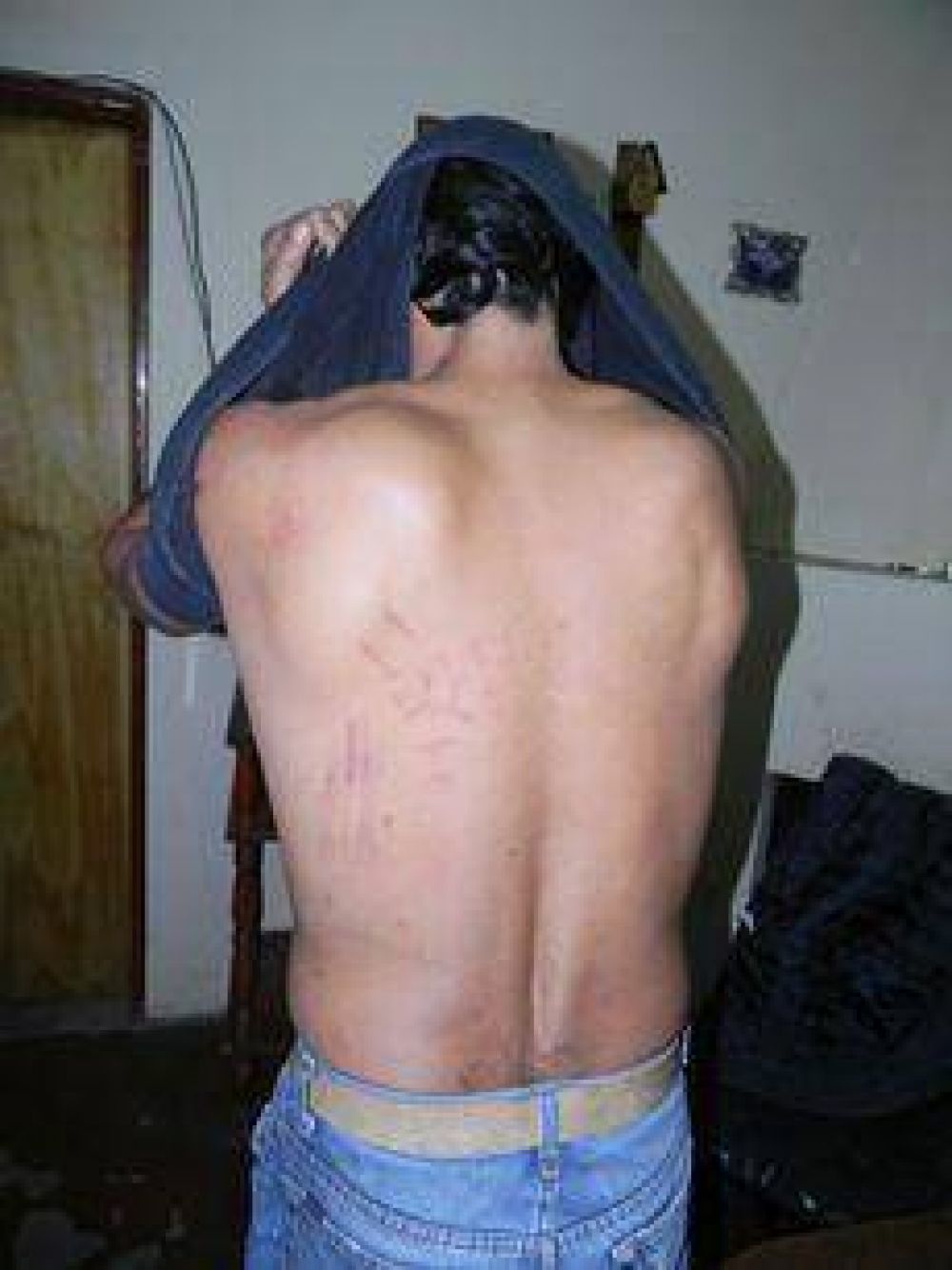 Un vecino denunci� que habr�a sido golpeado por la Polic�a de Moquehu� 
