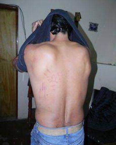 Un vecino denunci� que habr�a sido golpeado por la Polic�a de Moquehu� 
