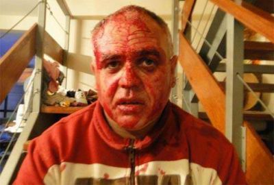 Brutal asalto a un kinesi�logo