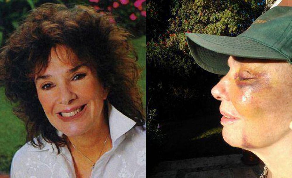 Graciela Borges mostr� una impactante foto de su rostro, a cuatro d�as de ser atropellada