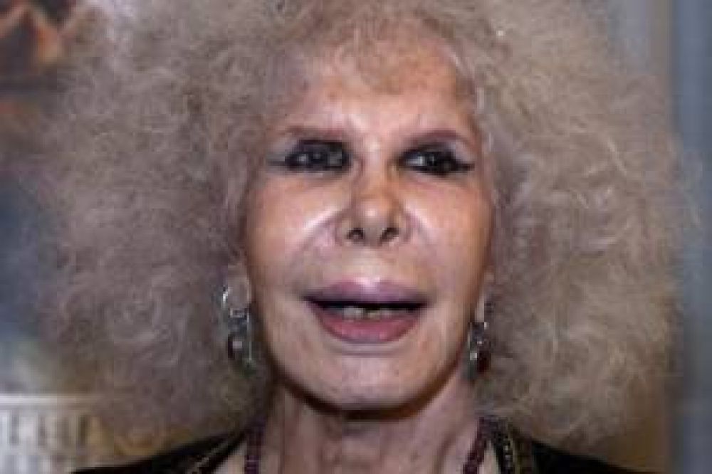 La duquesa de Alba se fractur� f�mur tras una ca�da