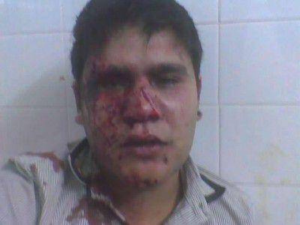Patovicas agreden a un joven en boliche de San Pedro