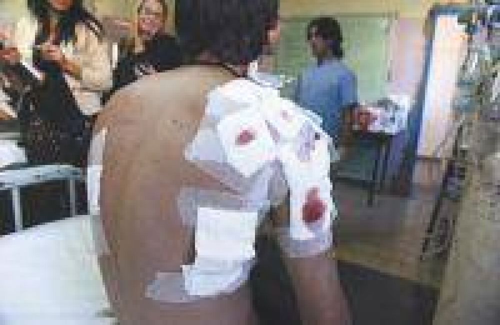 La punter�a policial no discrimin� a periodistas, m�dicos ni pacientes