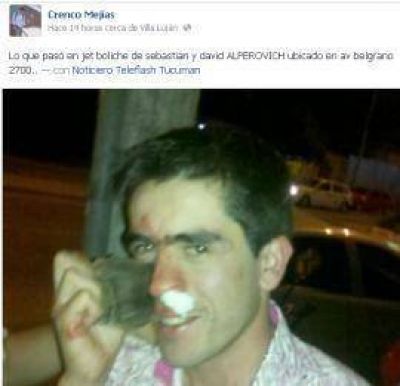 Denuncian que dieron feroz golpiza a joven en un boliche de los Alperovich