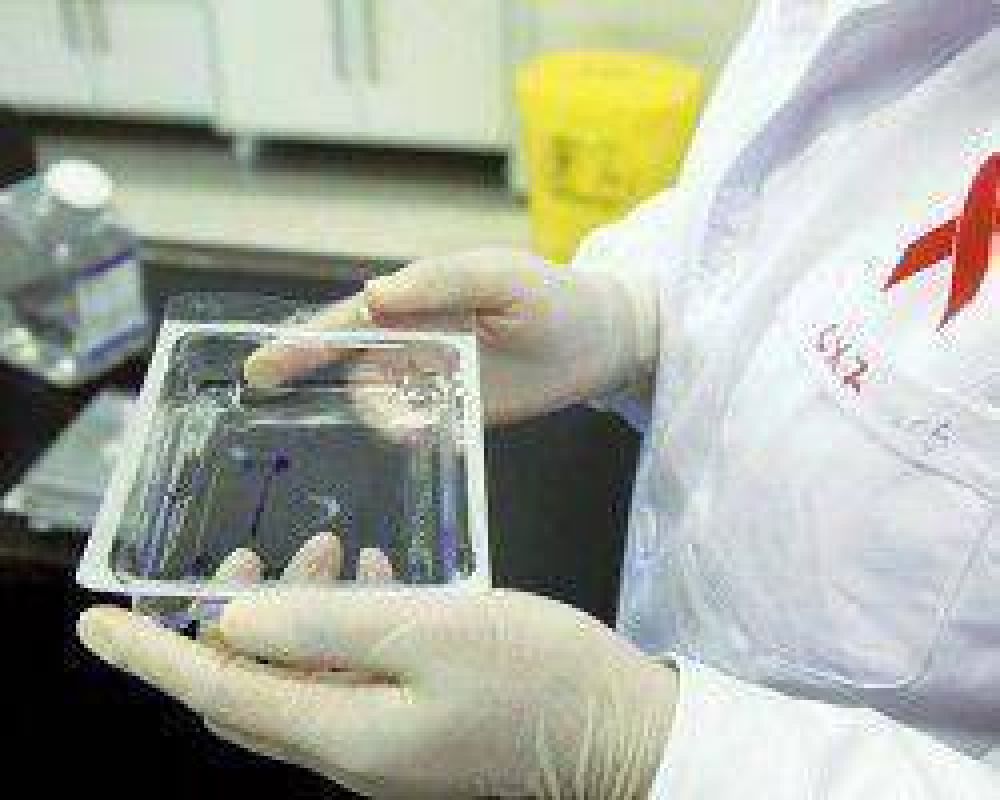HIV: crecieron un 182% los diagn�sticos positivos