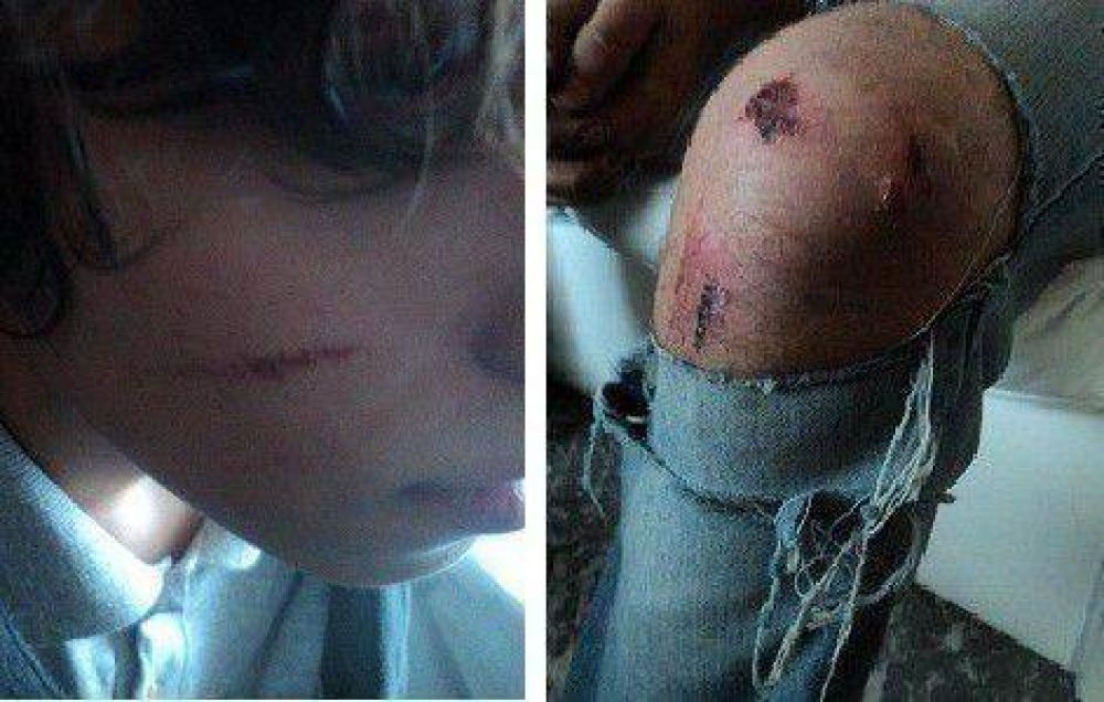 �Violencia escolar?: una patota golpe� gravemente a tres adolescentes en La Plata