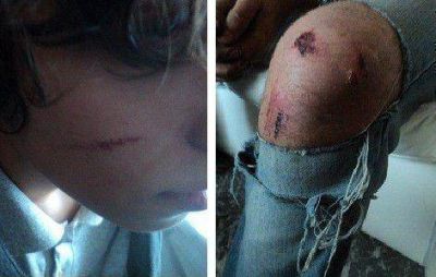 �Violencia escolar?: una patota golpe� gravemente a tres adolescentes en La Plata