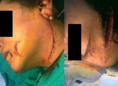 Caso bisagra: Alcaraz, la pediatra que fue desfigurada por su ex marido