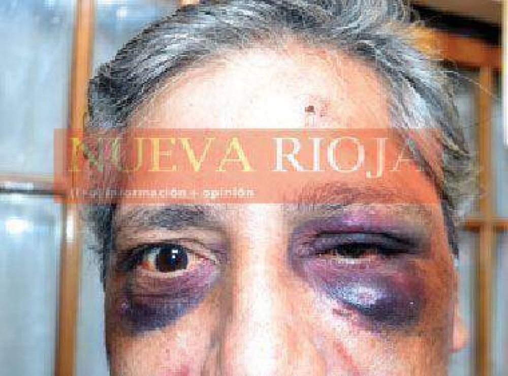 Feroz golpiza a un taxista para robarle la escasa recaudaci�n
