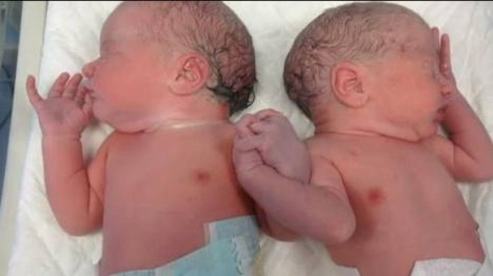 Dos mellizos que se dan la mano al nacer enternecen a todo un hospital