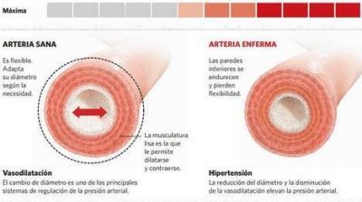 Hipertensi�n: la presi�n alta afecta cada vez m�s a los chicos y adolescentes