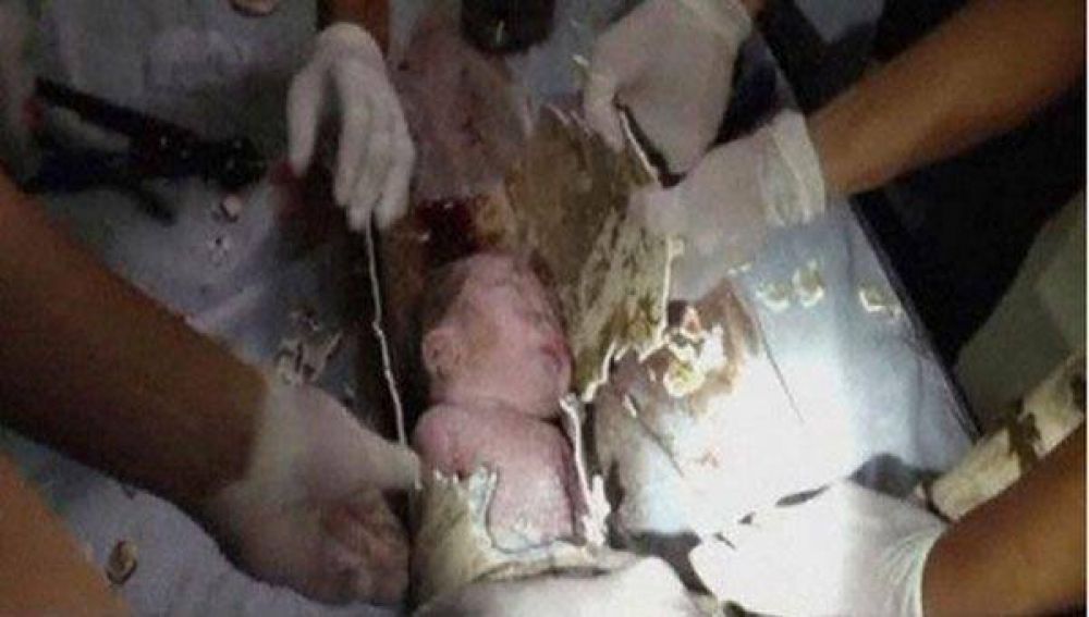  Milagro: rescatan a un beb� que hab�a sido tirado por el inodoro