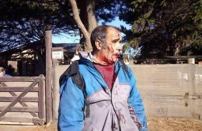 "Le tiraron a matar", dijo el hijo del cartero atacado por perros en Dina Huapi