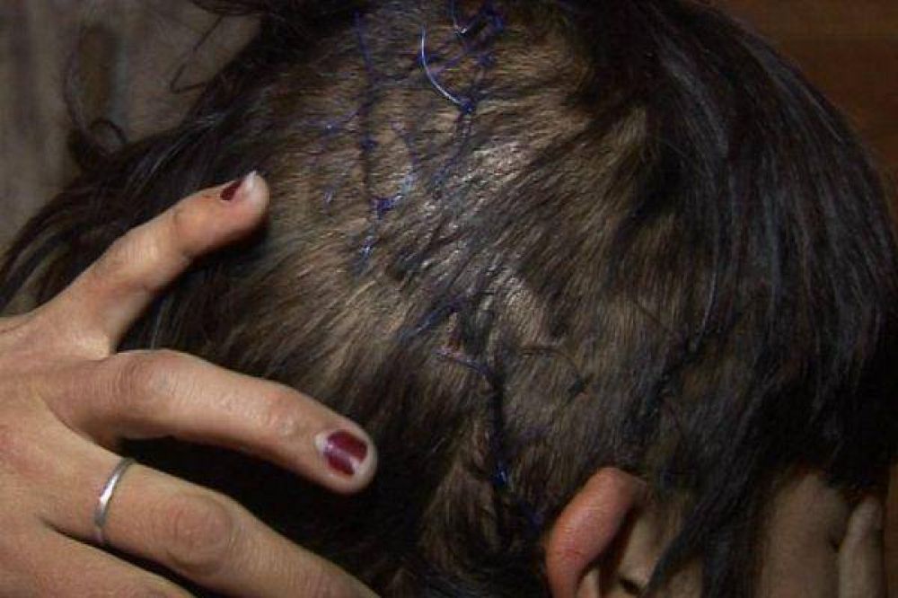  Dieron de alta al ni�o atacado por perros