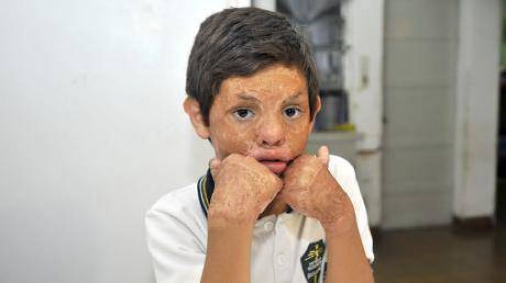 Tomasito necesita la ayuda de todos