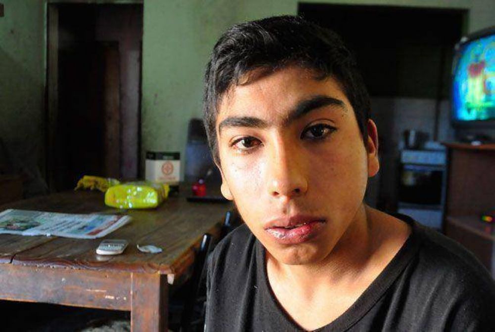 "Me dejaron inconciente", dijo un joven que denunci� una golpiza policial