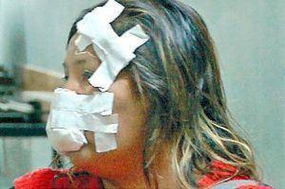 Desfigur� a su hermana en un feroz ataque a machetazos