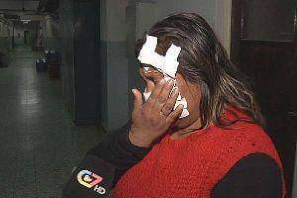 Ordenan aprehensi�n del sujeto que desfigur� a hermana
