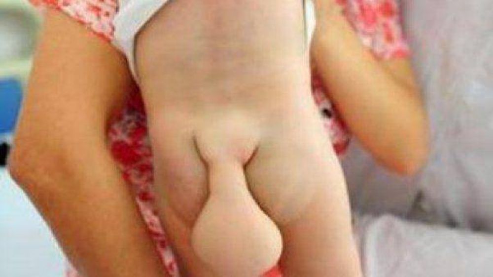 Conmoci�n por un bebe chino que tiene una "cola de castor"