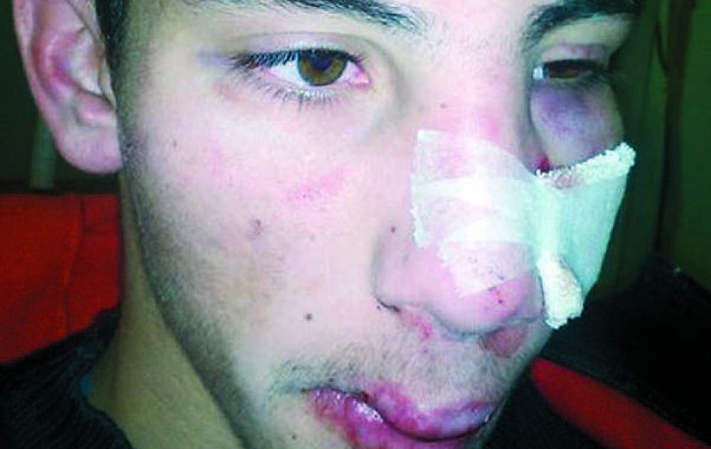 La brutal golpiza a un muchacho sacude a la comunidad de Armstrong