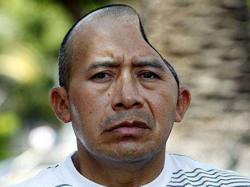 Indemnizan a hombre que perdi� parte de la cabeza