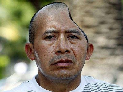 Indemnizan a hombre que perdi� parte de la cabeza