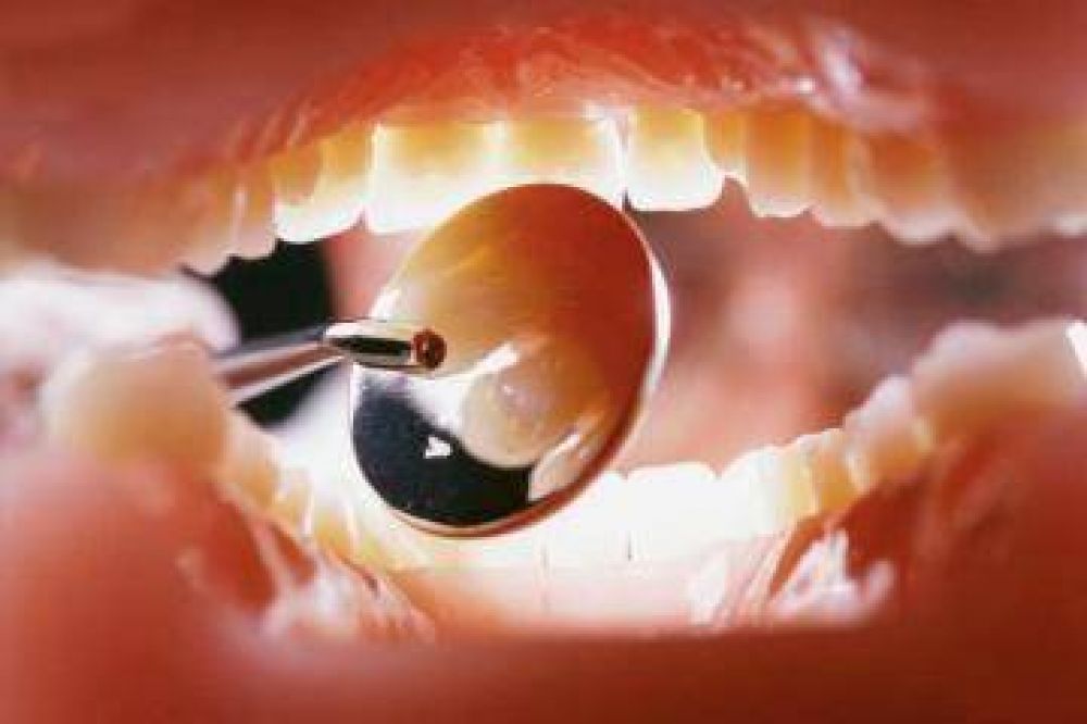 Ipross ya cubre cirug�as y pr�tesis odontol�gicas