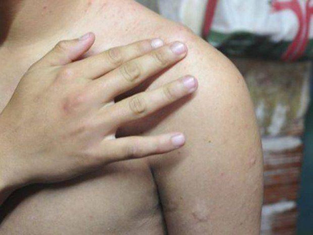 Denunciaron otro caso de mala atenci�n en el hospital San Bernardo