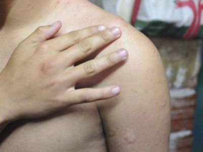 Denunciaron otro caso de mala atenci�n en el hospital San Bernardo