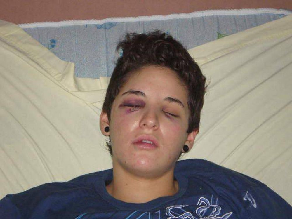 Brutal golpiza a una joven en un boliche