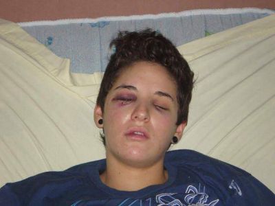 Brutal golpiza a una joven en un boliche