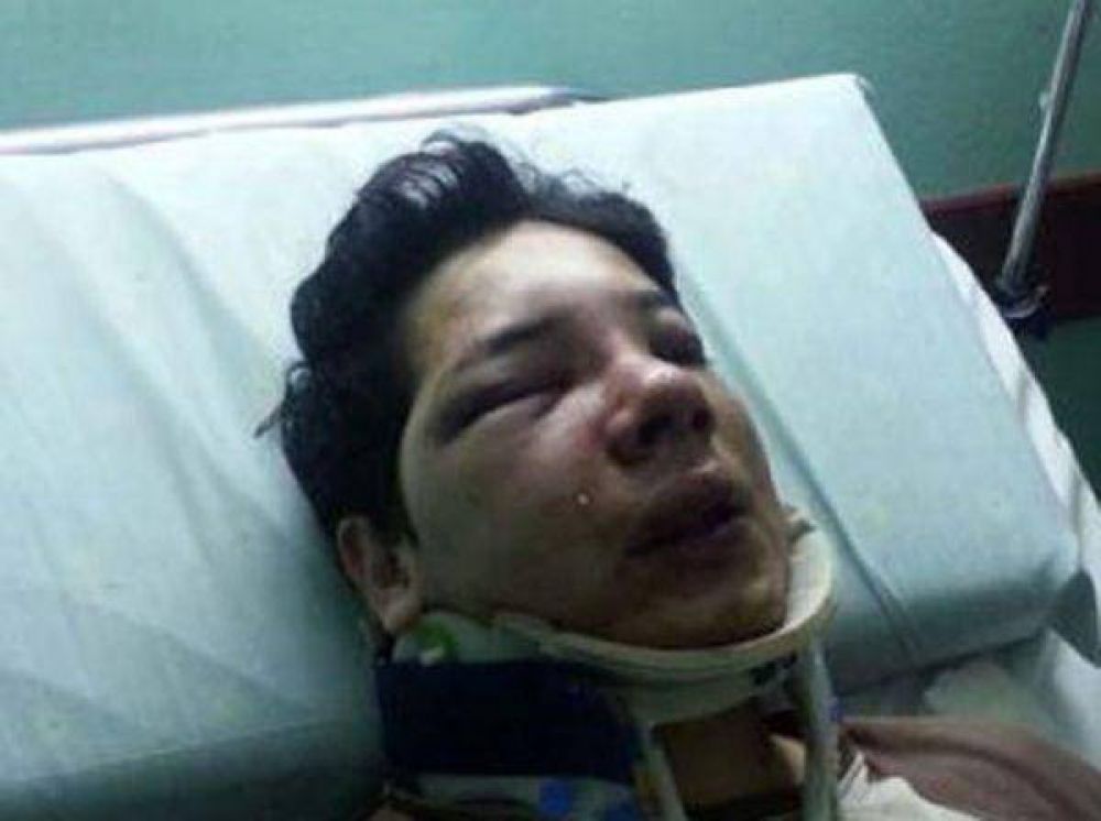 Salvaje paliza a delegado del CEC en Hipertehuelche 