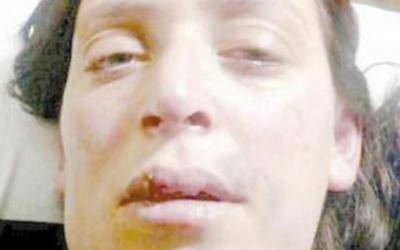 Rivadavia: Grave caso de violencia de g�nero sin respuesta policial