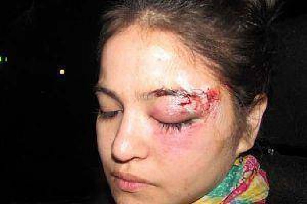 Dura agresi�n contra la hija de un polic�a en un boliche