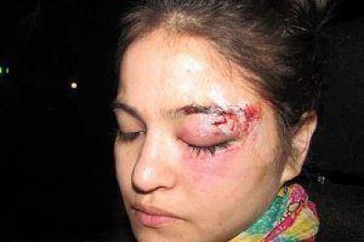 Dura agresi�n contra la hija de un polic�a en un boliche