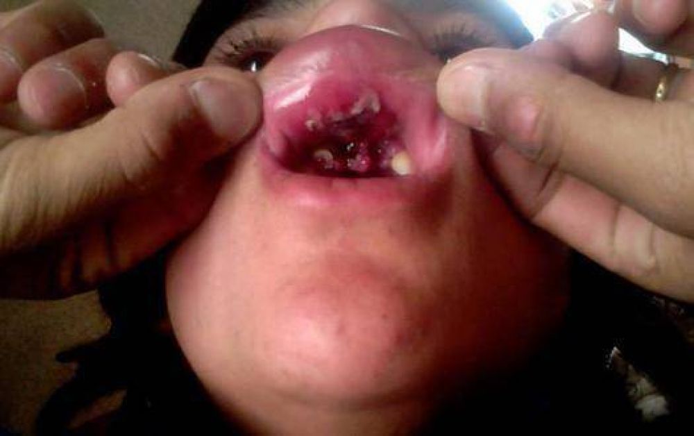 "Mi hijo puede reconocer al polic�a que le peg�"