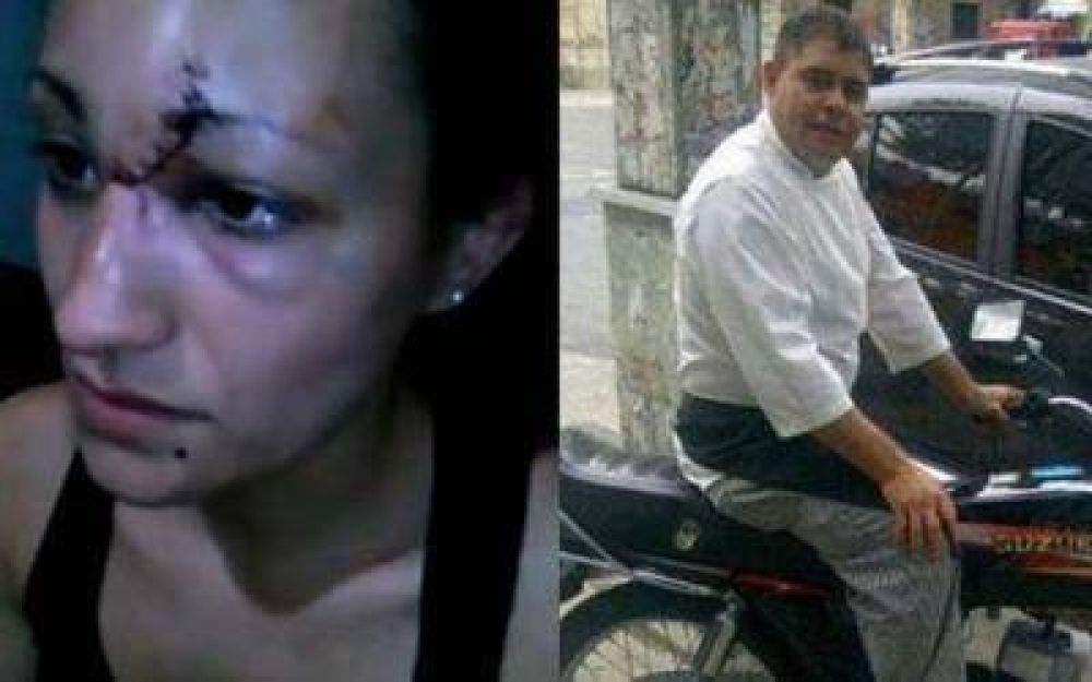 Violencia de g�nero: Detuvieron al hombre que desfigur� a su expareja