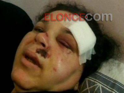 Intentaron arrebatarle la cartera a una mujer en moto: la �arrastraron� y result� lesionada al caer del rodado 