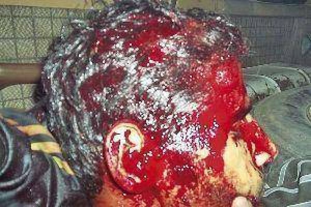Una mujer se defendi� y le abri� la cabeza a su marido con un cuchillo