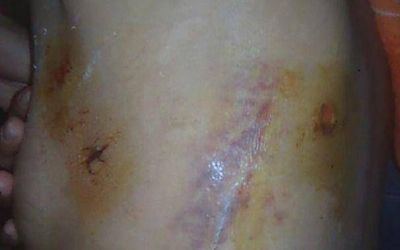Joven salvajemente golpeada pide ayuda por Facebook