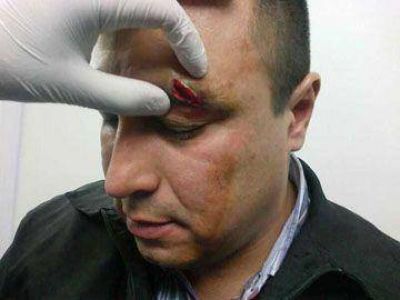 Polic�a herido en pelea de boliche nocturno