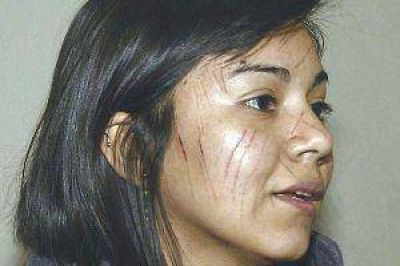 Una joven sufri� un brutal ataque en el rostro
