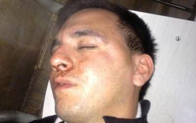 Lan�s: Denuncian a patovica por brutal golpiza a jugador de f�tbol a la salida de un boliche