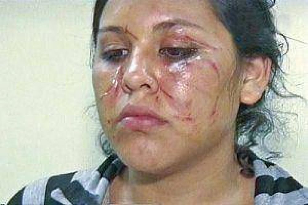 Una adolescente fue brutalmente golpeada por una vecina que la amenaz� de muerte