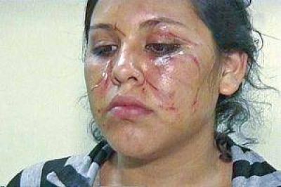 Una adolescente fue brutalmente golpeada por una vecina que la amenaz� de muerte