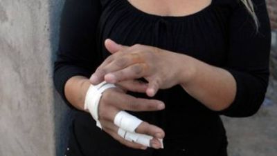 Le aplicaron varios puntazos en las manos para robarle el celular