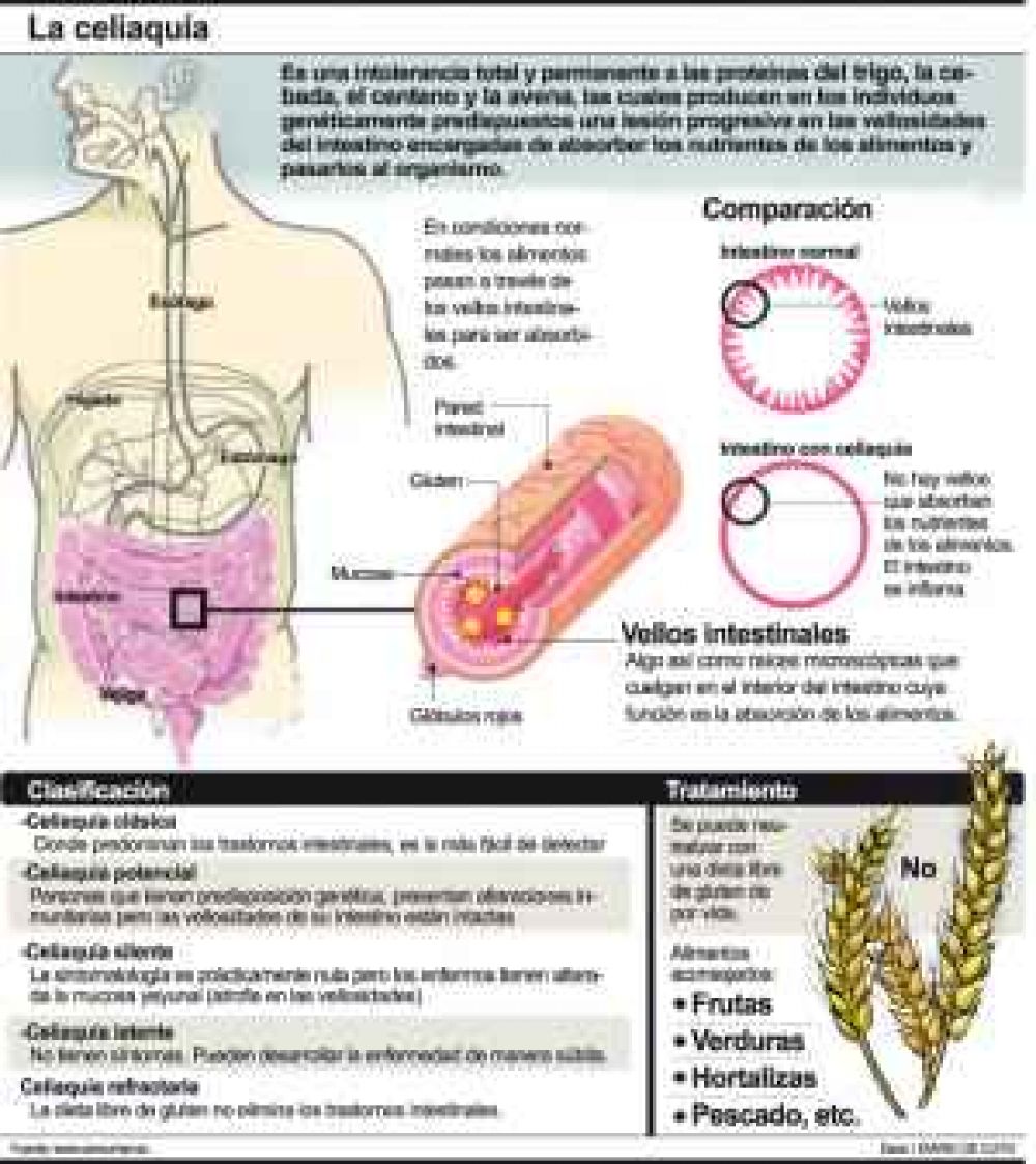 Inauguran el laboratorio que detecta el gluten
