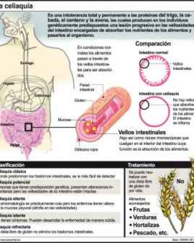 Inauguran el laboratorio que detecta el gluten